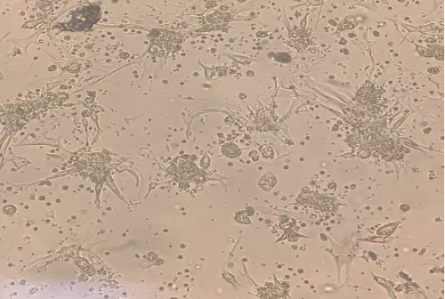 Spoke5_cardiomiociti