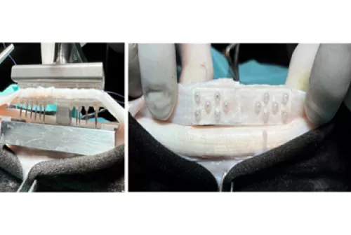 Spoke5_BRAVEimagepreview